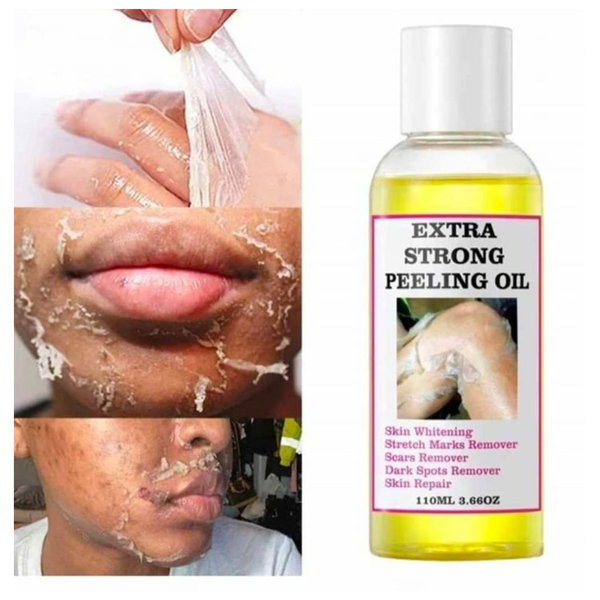 Extra Strong Peeling Oil