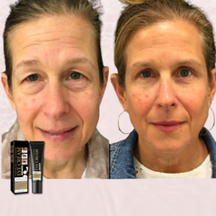 Skin Tightening + Eyebag Removal Cream ✨