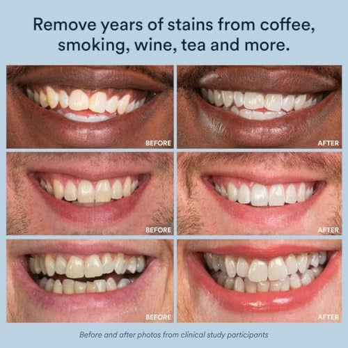 Mirova Teeth Whitening pen