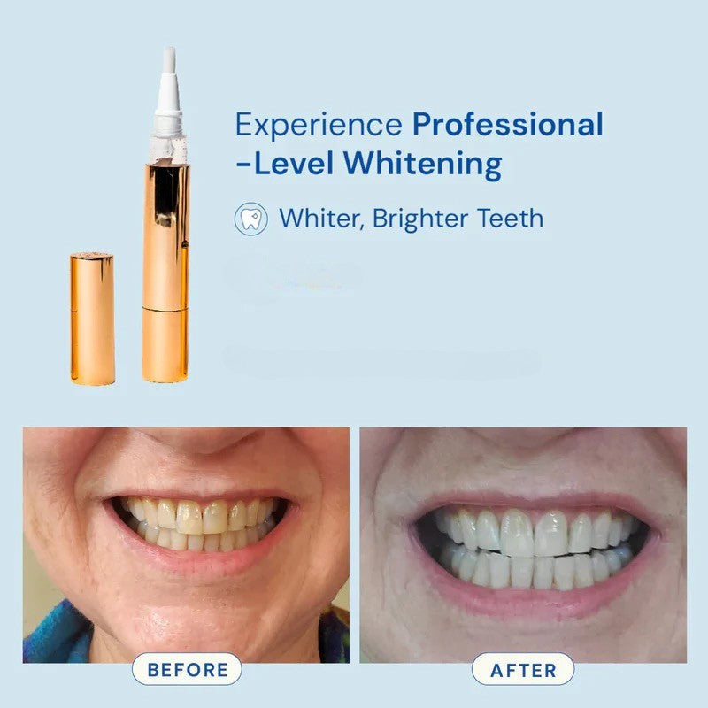 Mirova Teeth Whitening pen