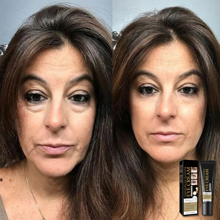 Skin Tightening + Eyebag Removal Cream ✨