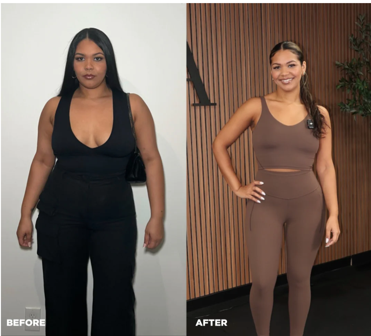 GLP-1 Weight loss Patches