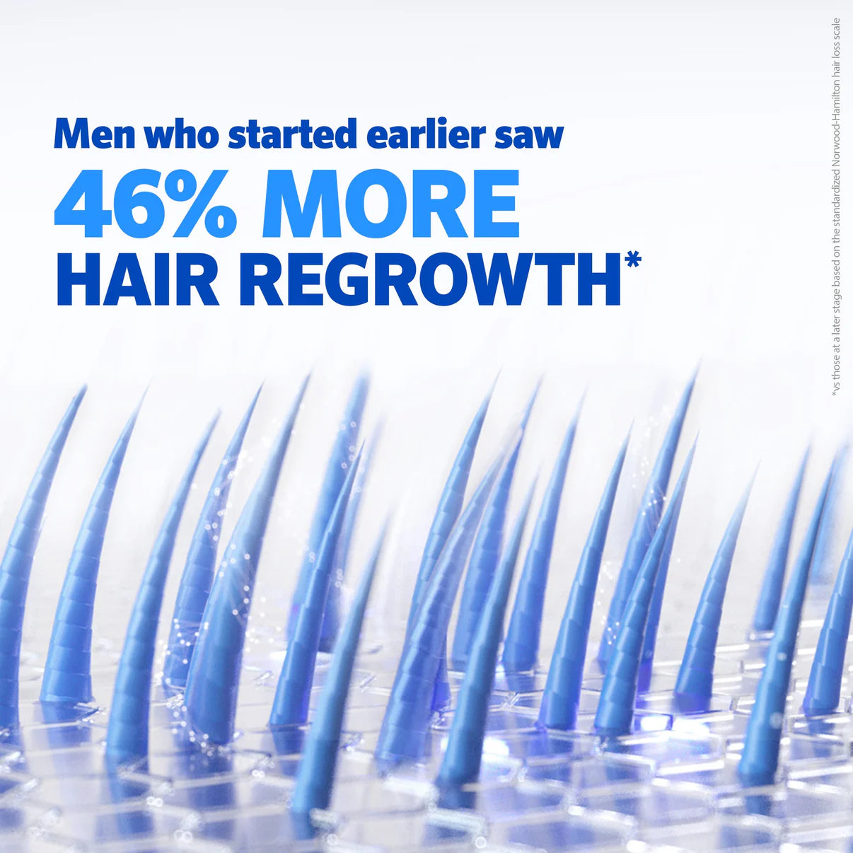 Minoxidil Hair growth Solution