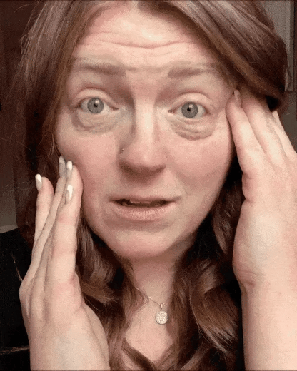 Skin Tightening + Eyebag Removal Cream ✨