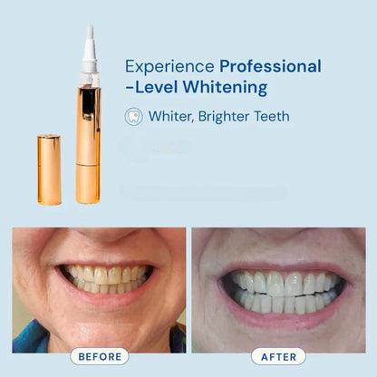 Mirova Teeth Whitening pen