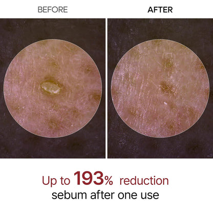 Dr.Melaxin Peel Shot Glow Exfoliant Rice Ampoule Black Rice