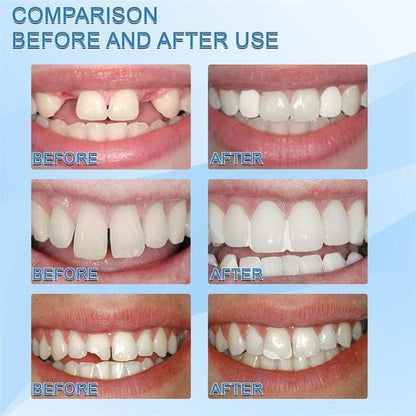 Temporary Teeth Repair Kit