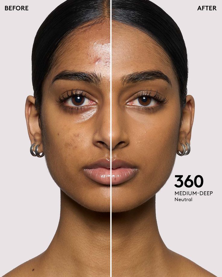 Reveal Your Skin's Radiance and Confidence!