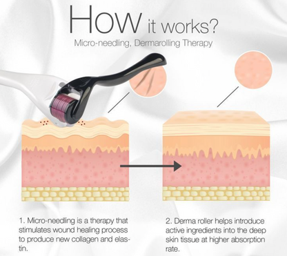 Derma Roller| Micro Needling Treatment