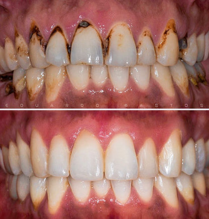 Dr Dent Teeth Whitening Strips (42 Strips)