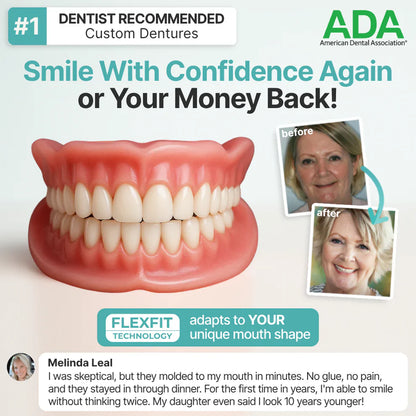 TrueEase™ Custom-Fit Full Functional Dentures