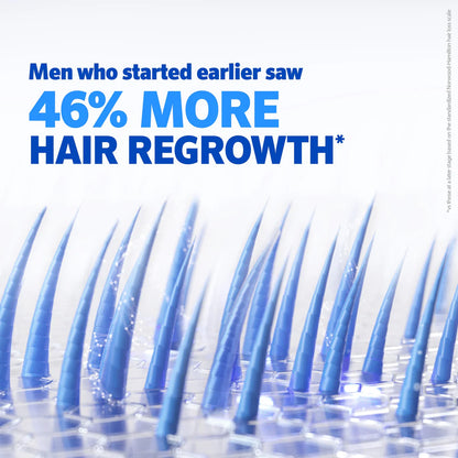 Minoxidil Hair growth Solution