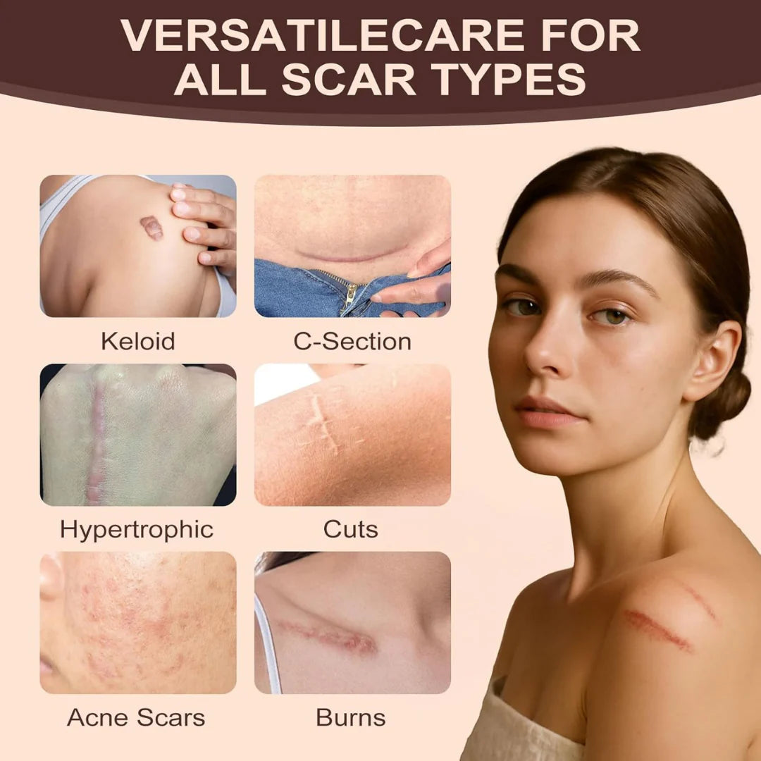 Medibeauty™  Anti-Aging Silicone Scar-Stick