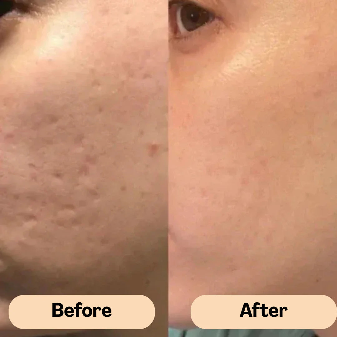 Medibeauty™  Anti-Aging Silicone Scar-Stick